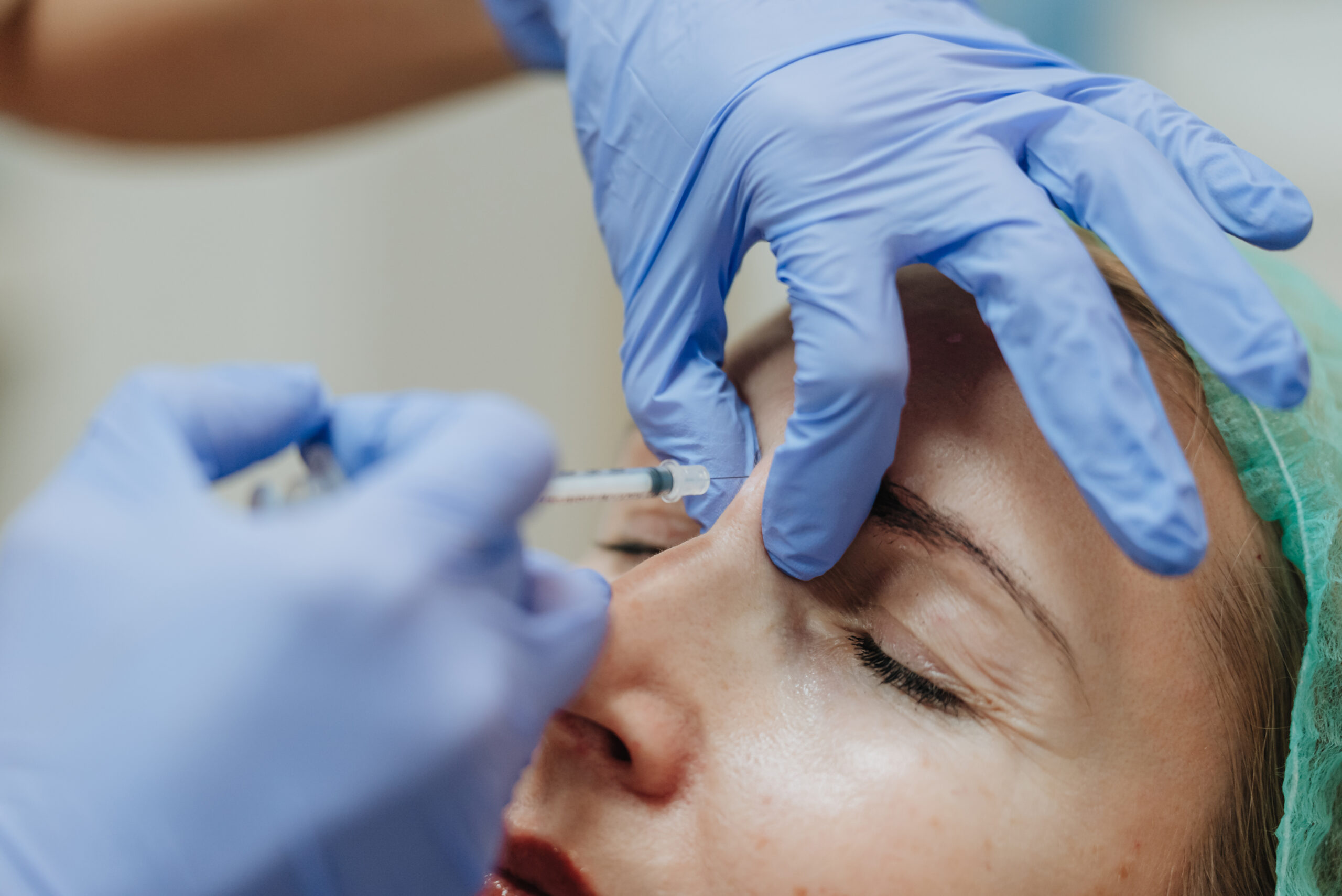 Mimikos raukšlių korekcija