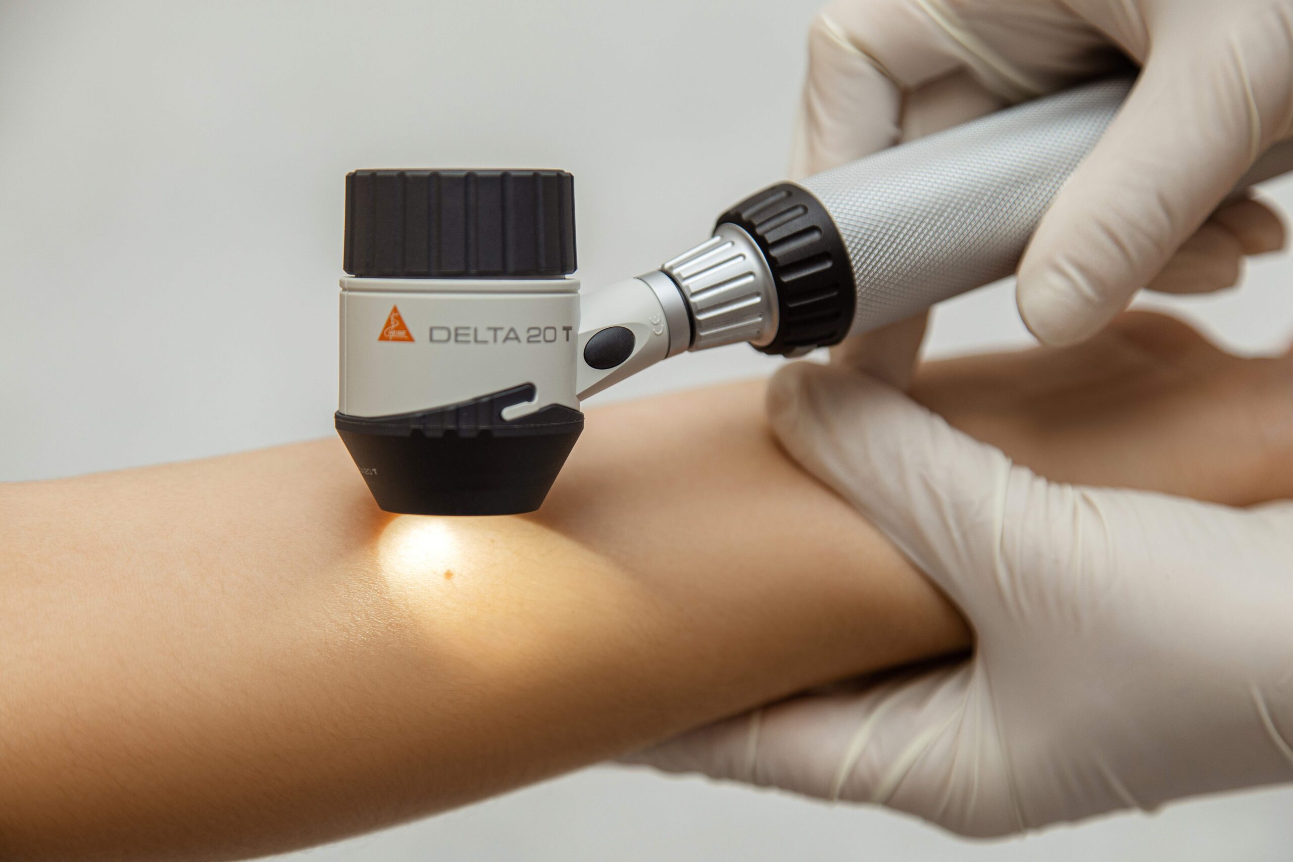 Konsultacija Skaiderma